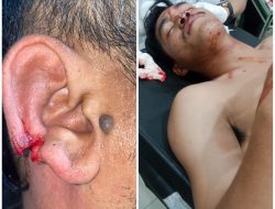 Penanganan Humanis di Dairi: 10 Personel Terluka, Polda Sumut Tegaskan Komitmen Jaga Kamtibmas