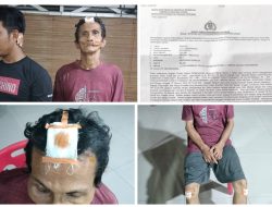 Korban Pengeroyokan Hingga Mengalami Luka Berat, Minta Kapolda Sumut Segera Tangkap Pelaku
